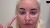 Amanda Bynes calls eyelid surgery 'one of the best things' for her self confidence