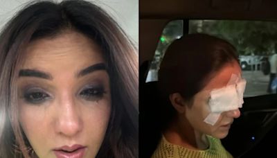 Jasmin Bhasin Reveals Lens Mishap Damaged Her Corneas, Says 'I am in a Lot of Pain'