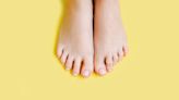 Here’s How To Tell if Your Toenail Fungus Is Dying + 3 Natural Remedies To Speed Healing