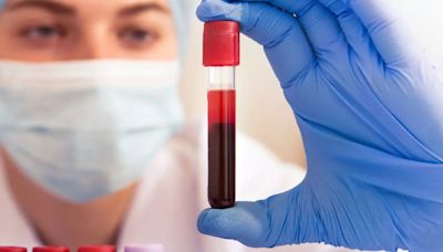 New Blood Test To Detect Colon Cancer Approved By FDA