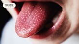 How to spot if your child has scarlet fever and what to do about it