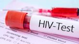 HC seeks reports from state, Centre over rising HIV cases in Tripura - ET LegalWorld