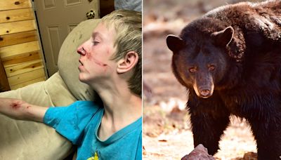 Adolescente se recupera tras el ataque de un oso negro en Arizona
