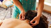 What You Need to Know About Acupuncture