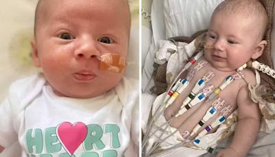 Bebé es llevado a hospital por herpes labial y recibe un diagnóstico devastador en Reino Unido