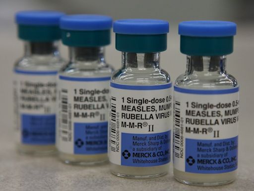 Dane County measles case prompts state health department to alert the public