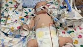 Texas Baby Born with Only Half a Heart Dies from the Rare Defect: 'Our Guardian Angel'