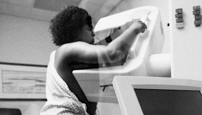 Landmark study of cancer in Black women launches in 20 states, aiming to be largest ever