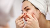 The Complete Guide To Safely Popping A Pimple On Your Own