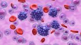 Multidrug Regimen Could Change Treatment Landscape for Relapsed/Refractory DLBCL