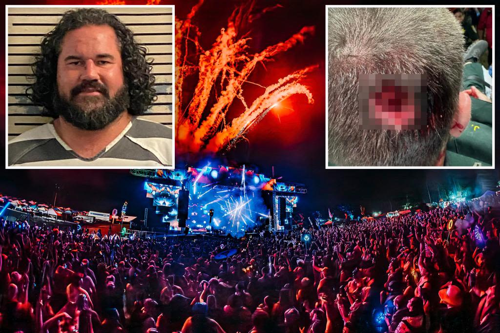 Drugged-out Florida man arrested after biting off piece of cop’s head at music festival