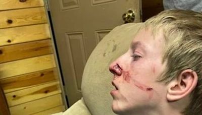 Teen survives terrifying bear attack thanks to his brother