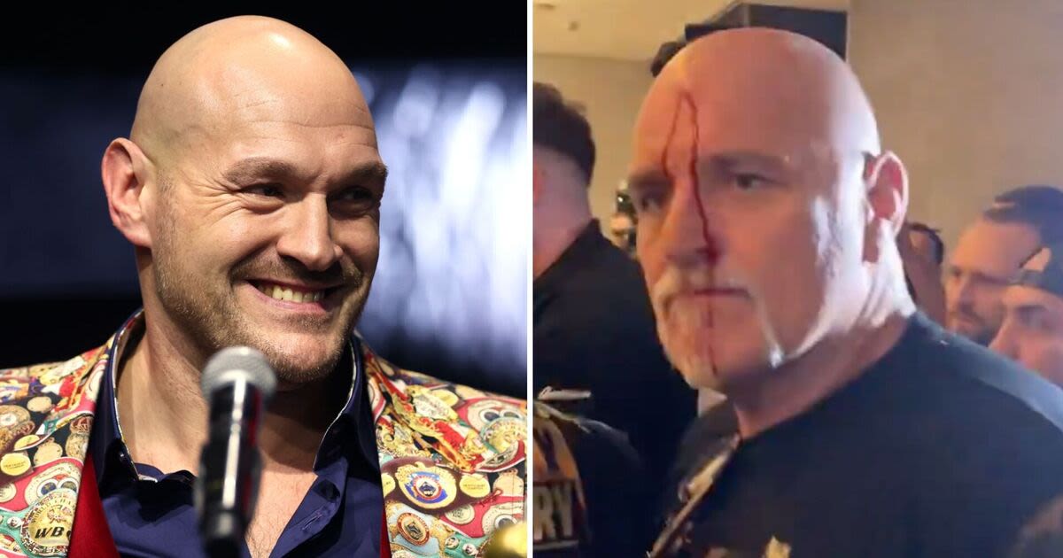 Tyson Fury gives totally expected response to dad John's violent headbutt