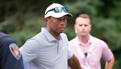 What does Tiger Woods’ injured right leg look like? New photos show scars