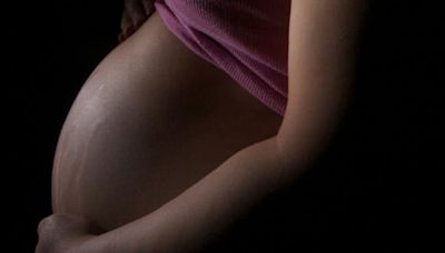 Dia das mães: tudo o que você precisa saber sobre estrias na gravidez
