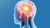 Blood cancer medication makes radiation therapy on brain tumours more effective, study reveals how