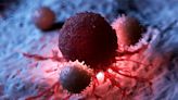 Cancer Breakthrough: Scientists Discover Game-Changing New Type of T Cells