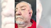 Felony charges filed in beating of 81-year-old man at Redondo Beach Elks Lodge