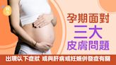 孕期3大皮膚問題紅疹、暗瘡、妊娠紋 某種情況可能患妊娠併發症