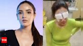 Jasmine Bhasin shares health update post-her corneal damage; says, “I’m out of the danger zone” - Times of India