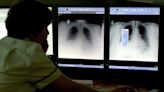 AI tools to improve people’s health could put them at risk in other ways, doctors warn