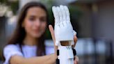Estudiante de 14 años desarrolla prótesis de mano con impresora tridimensional