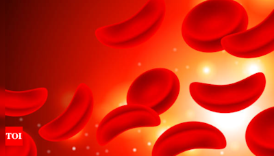 Understanding the landscape of sickle cell disease in India - Times of India