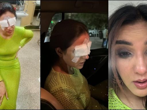 'I cant see, in immense pain': Jasmin Bhasin suffers corneal damage; lens mishap leaves her in pain