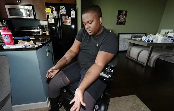 Ex-Police Recruit Files Suit After Losing Legs in Alleged ‘Barbaric' Hazing Ritual: 'No Idea What My Future Holds'