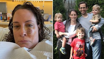 Melanoma patients reveal dramatic stories for Skin Cancer Awareness Month: ‘I thought I was careful’