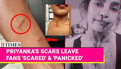 Priyanka Chopra's 'Bruised' BTS Video Leaves Fans 'Panicked': 'When You Do Action Movies, It’s Really Glamorous...