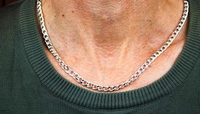 Colorado Man Saved From Near-Fatal Bullet Wound by Silver Necklace