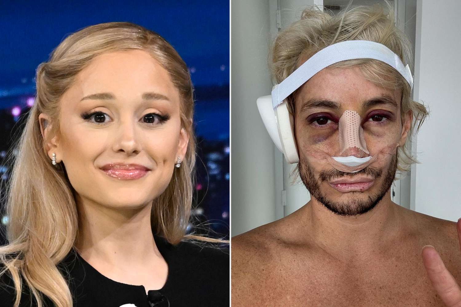 Ariana Grande Supports Brother Frankie’s Nose Job: ‘Perfect in All Ways, Always!!!!’