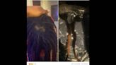 Mom of North Texas freshman says teacher pulled her son’s dreadlocks out when removing hat