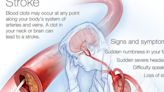 Mayo Clinic raises awareness of stroke risks during American Stroke Month