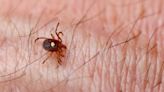 Tick-related meat allergies are on the rise — yet most doctors don't recognize the symptoms