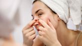 The Complete Guide To Safely Popping A Pimple On Your Own