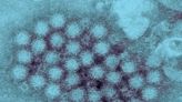 Norovirus Is on the Rise. What to Know About Symptoms and Treatment