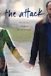 The Attack (2012 film)