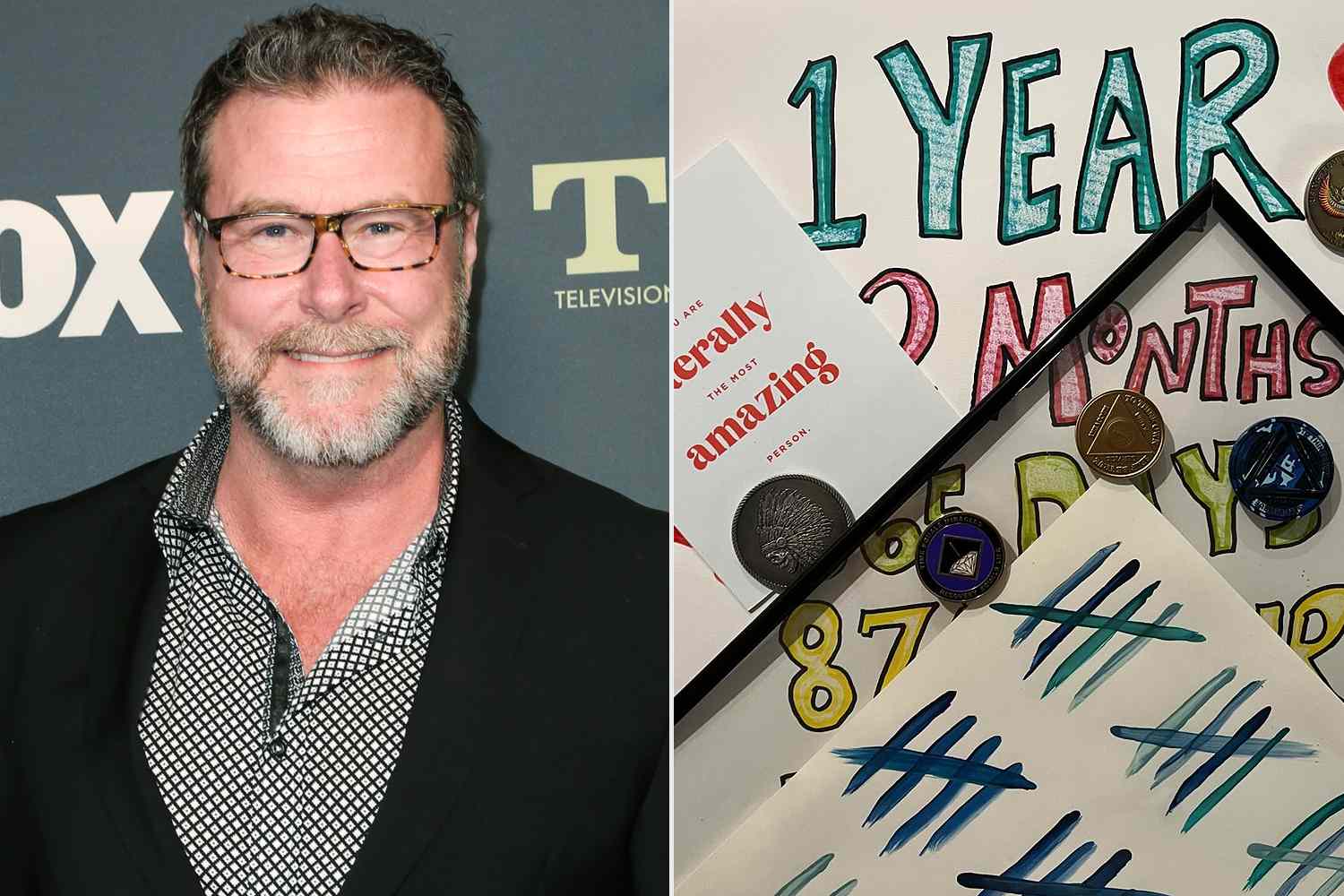 Dean McDermott Celebrates 1 Year of Sobriety: 'A Beautiful Life Awaits'