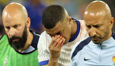 La duda de Mbappé en la primera fase, la dependencia de Francia de su figura