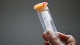 First pill for dengue shows promise in human challenge trial