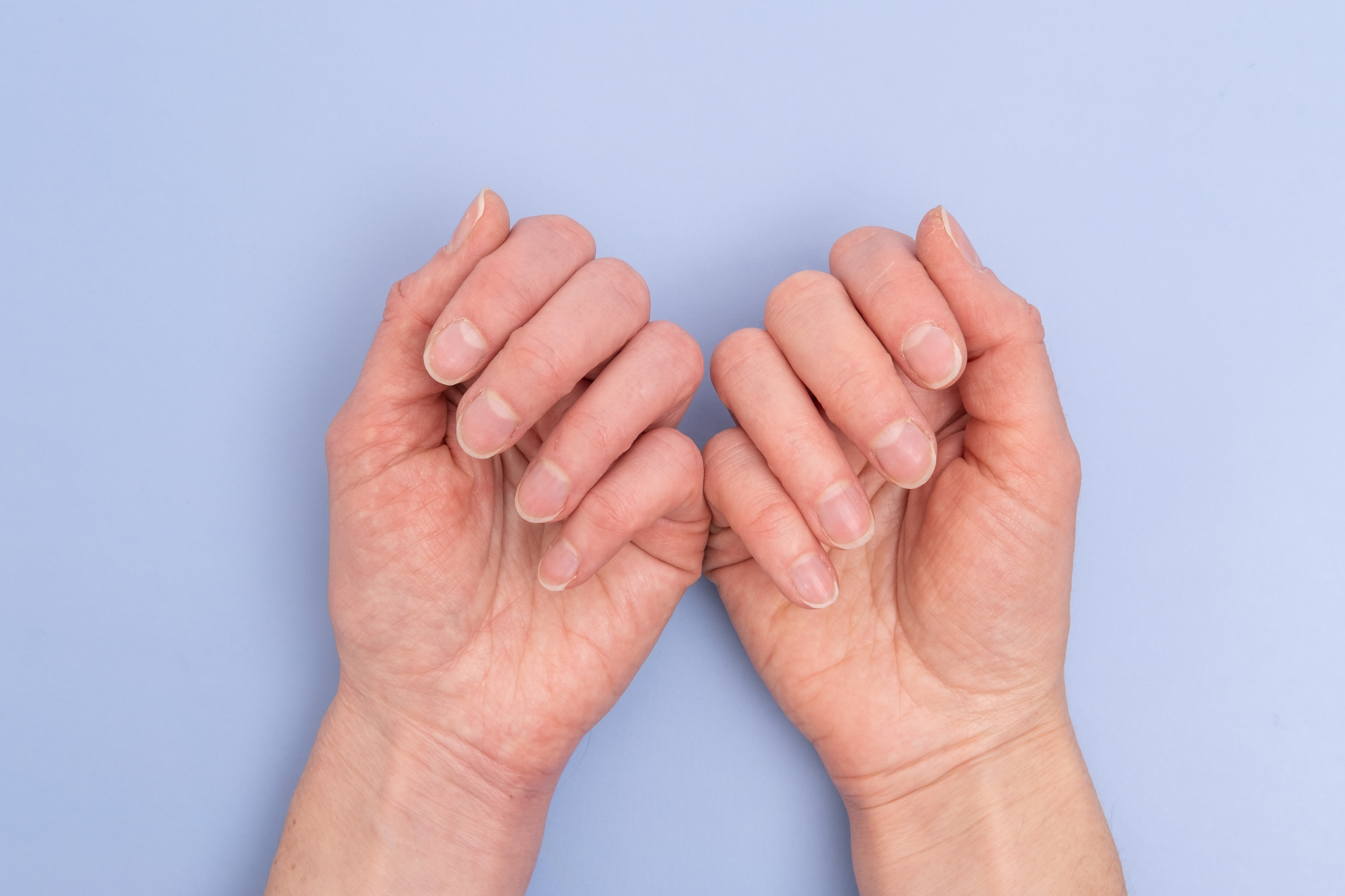 7 signs in your nails that could indicate a serious health condition