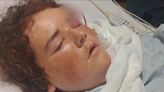 Texas boy left with pipe sticking out of head after swim with friends