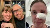 Small bump under mum’s eye turned out to be skin cancer