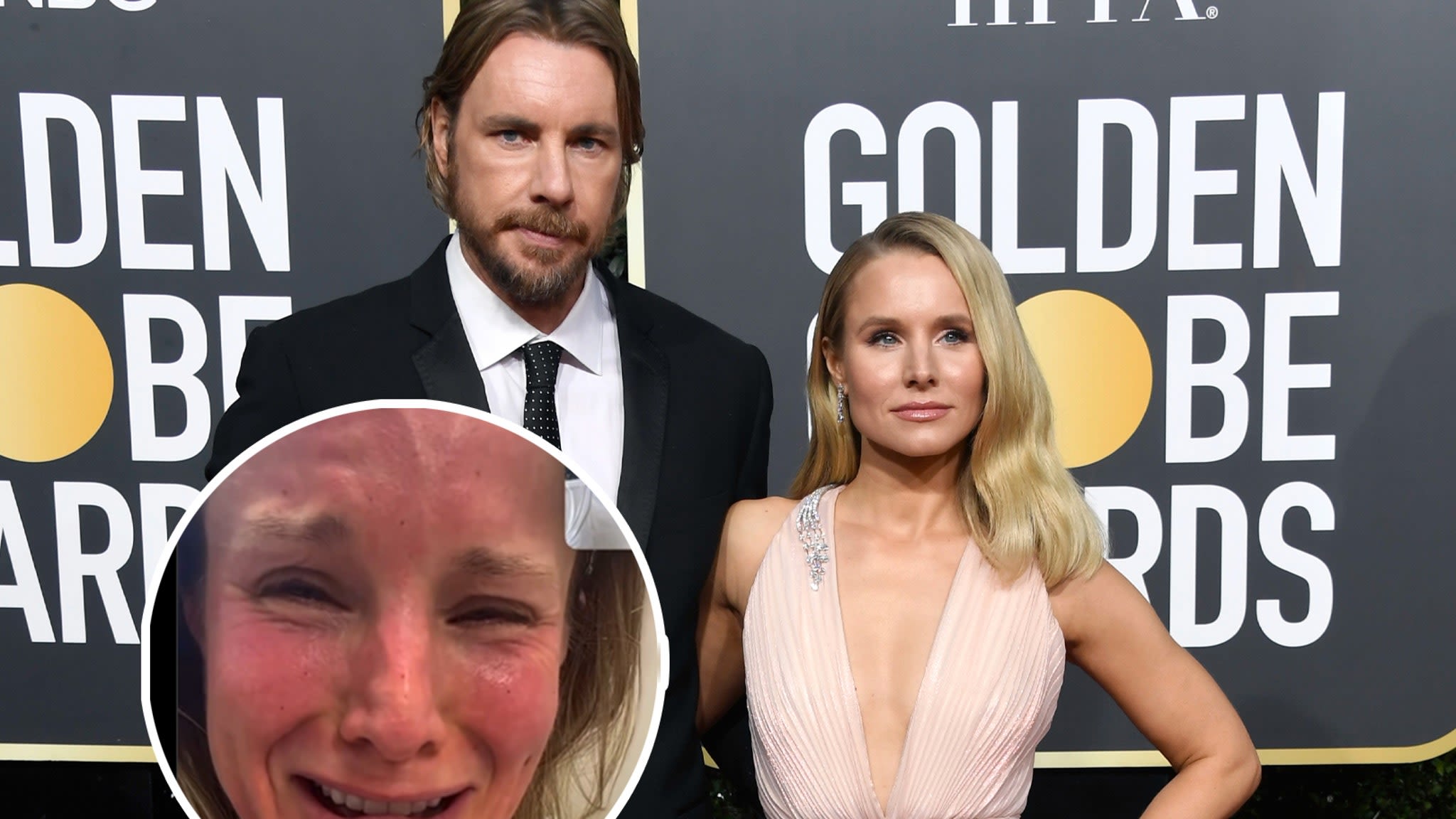 Dax Shepard Shares Video of Kristen Bell 'Gassed' On Nitrous at Dermatologist