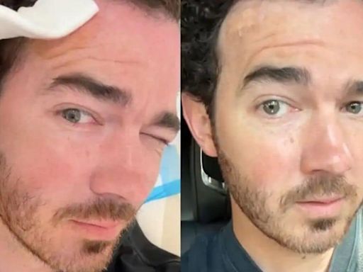 WATCH: Nick Jonas' brother Kevin Jonas diagnosed with skin cancer, says 'A small mole on my forehead…'
