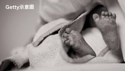 印度婦誕下「8手腳2張臉」嬰兒嚇親接生員 村民好奇湧入醫院圍觀