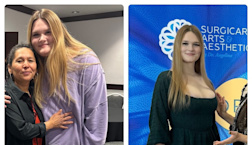 These Ozempic Before and After Photos Give a Real-Life Glimpse of What Life is Like on Weight Loss Medication