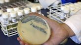 'Superbug' infections, deaths rose at beginning of COVID-19 pandemic